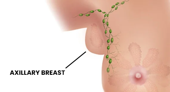 what is axillary breast
